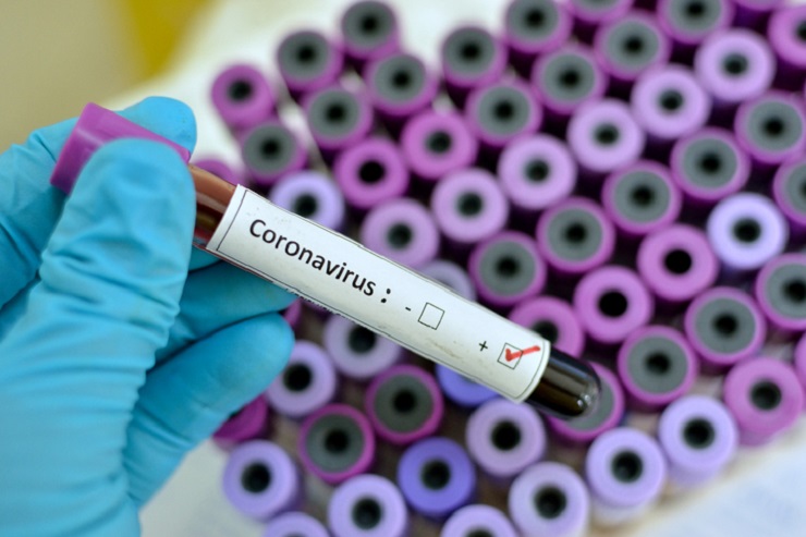 coronavirus beakers in a lab